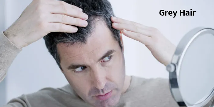 Home Remedies For Grey Hair