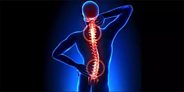 Back Pain Overview, Causes, Symptoms