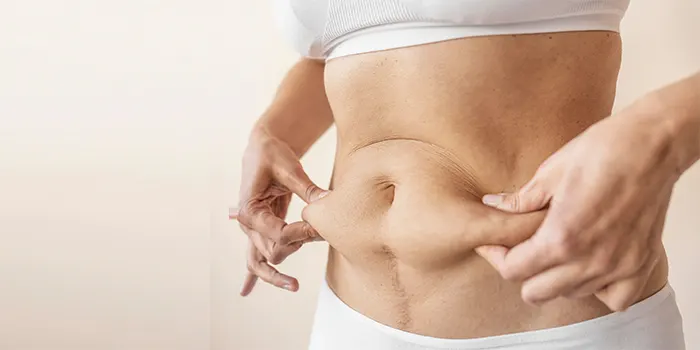 Belly Fat: causes, Tips & Home Remedies