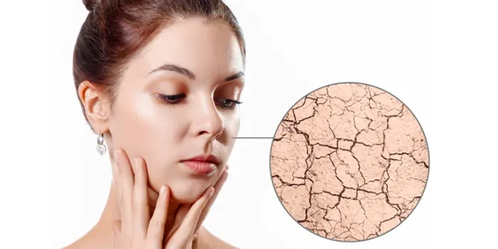 Dry skin: Causes, Tips & Home remedies
