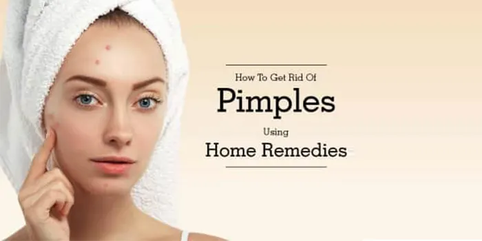 Pimples or Acne: causes and remedies 